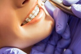 Medical Dentist: Dentisti a Roma