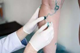 Rigenerazione vascolare: nuove prospettive per la salute delle arterie e delle vene
